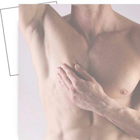 depilacion laser de hombres madrid